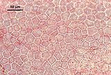 4 - Cellule corticali in visione superficiale